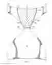 Fig. 06 - Apparatus for providing tension in garments and method of use