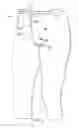 Fig. 10 - Apparatus for providing tension in garments and method of use