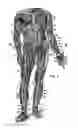 Fig. 10 - RESISTANCE EXERCISE CLOTHING