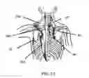 Fig. 14 - RESISTANCE EXERCISE CLOTHING