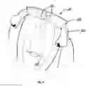 Fig. 08 - Article of clothing for storing and deploying a scarf