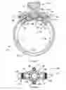 Fig. 08 - Interchangeable jewelry, particularly a ring assembly
