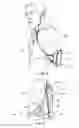 Fig. 05 - COMBINATION AND SUPPORT DEVICE FOR SECURING A HANDHELD OBJECT TO A USER OR STRUCTURE