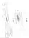 Fig. 02 - Oral care implement