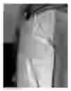 Fig. 05 - DETACHABLE SHEET AND WATERPROOF PAD SYSTEM