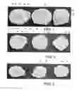 Fig. 02 - Methods and Devices for Making Pre-Cooked Eggs Having a Natural Appearance