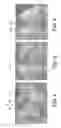 Fig. 03 - Methods and Devices for Making Pre-Cooked Eggs Having a Natural Appearance