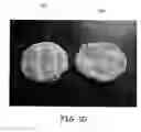 Fig. 06 - Methods and Devices for Making Pre-Cooked Eggs Having a Natural Appearance