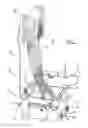 Fig. 02 - Beach Bucket