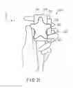 Fig. 13 - Insertion instrument and insertion apparatus comprising this insertion instrument