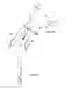 Fig. 04 - Endobronchial tube with integrated image sensor