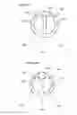 Fig. 09 - Endobronchial tube with integrated image sensor
