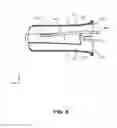 Fig. 06 - Minimally obstructive compact speculum