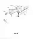 Fig. 07 - Minimally obstructive compact speculum