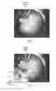 Fig. 07 - Magnification in ophthalmic procedures and associated devices, systems, and methods