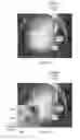 Fig. 08 - Magnification in ophthalmic procedures and associated devices, systems, and methods