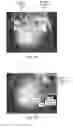 Fig. 09 - Magnification in ophthalmic procedures and associated devices, systems, and methods