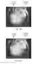Fig. 11 - Magnification in ophthalmic procedures and associated devices, systems, and methods