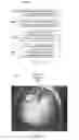 Fig. 15 - Magnification in ophthalmic procedures and associated devices, systems, and methods