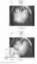 Fig. 16 - Magnification in ophthalmic procedures and associated devices, systems, and methods