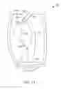 Fig. 12 - Laser catheter with use of reflected light to determine material type in vascular system