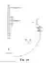 Fig. 07 - Methods, devices and systems for sensing, measuring and/or characterizing vessel and/or lesion compliance and/or elastance changes during vascular procedures