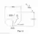 Fig. 11 - Methods, devices and systems for sensing, measuring and/or characterizing vessel and/or lesion compliance and/or elastance changes during vascular procedures