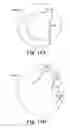 Fig. 16 - Methods, devices and systems for sensing, measuring and/or characterizing vessel and/or lesion compliance and/or elastance changes during vascular procedures