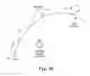 Fig. 19 - Methods, devices and systems for sensing, measuring and/or characterizing vessel and/or lesion compliance and/or elastance changes during vascular procedures