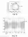 Fig. 20 - Methods, devices and systems for sensing, measuring and/or characterizing vessel and/or lesion compliance and/or elastance changes during vascular procedures