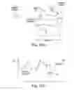 Fig. 10 - METHODS, DEVICES AND SYSTEMS FOR SENSING, MEASURING AND/OR CHARACTERIZING VESSEL AND/OR LESION COMPLIANCE AND/OR ELASTANCE CHANGES DURING VASCULAR PROCEDURES