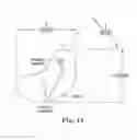 Fig. 11 - METHODS, DEVICES AND SYSTEMS FOR SENSING, MEASURING AND/OR CHARACTERIZING VESSEL AND/OR LESION COMPLIANCE AND/OR ELASTANCE CHANGES DURING VASCULAR PROCEDURES