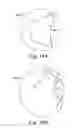 Fig. 16 - METHODS, DEVICES AND SYSTEMS FOR SENSING, MEASURING AND/OR CHARACTERIZING VESSEL AND/OR LESION COMPLIANCE AND/OR ELASTANCE CHANGES DURING VASCULAR PROCEDURES