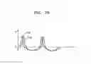 Fig. 16 - Apparatus and method of measuring pulse wave