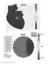 Fig. 10 - Non-invasive method and system for characterizing cardiovascular systems