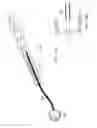 Fig. 23 - CATHETER-BASED CLUTCHED HEART VALVE SIZER