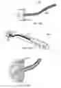 Fig. 24 - CATHETER-BASED CLUTCHED HEART VALVE SIZER