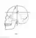 Fig. 04 - METHOD FOR DIAGNOSING CRANIAL BONE DISPLACEMENT
