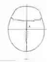 Fig. 06 - METHOD FOR DIAGNOSING CRANIAL BONE DISPLACEMENT