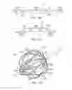 Fig. 15 - Basket catheter with improved spine flexibility