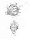 Fig. 17 - Basket catheter with improved spine flexibility