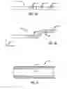 Fig. 06 - CT-ENHANCED FLUOROSCOPY