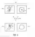 Fig. 03 - Micromanipulator-controlled local view with stationary overall view
