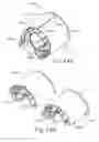 Fig. 45 - Biopsy device