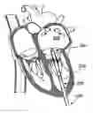Fig. 01 - Orientation device for use in mitral valve repair