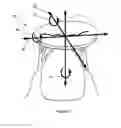 Fig. 02 - Orientation device for use in mitral valve repair