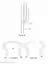Fig. 17 - Orientation device for use in mitral valve repair