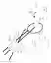 Fig. 07 - Pneumoperitoneum device