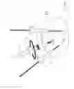 Fig. 17 - Pneumoperitoneum device