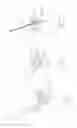 Fig. 24 - Pneumoperitoneum device